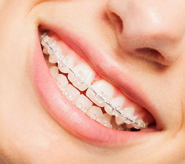 Port Chester Invisible Orthodontics