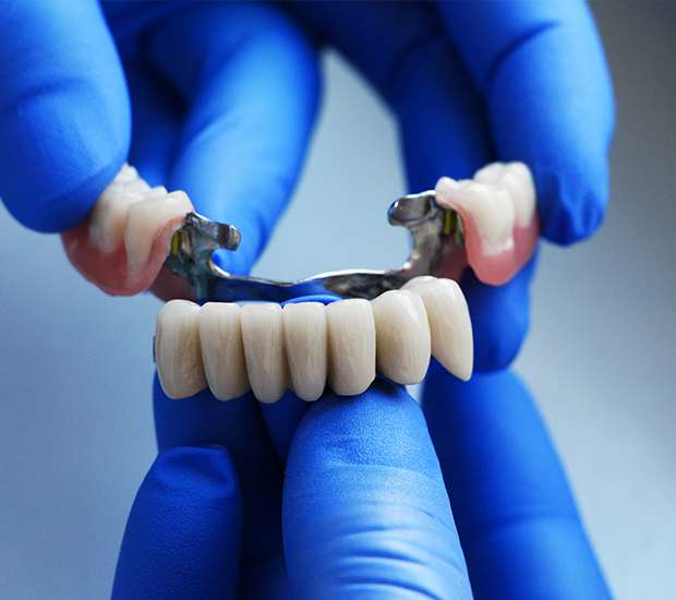 Port Chester Dental Bridges