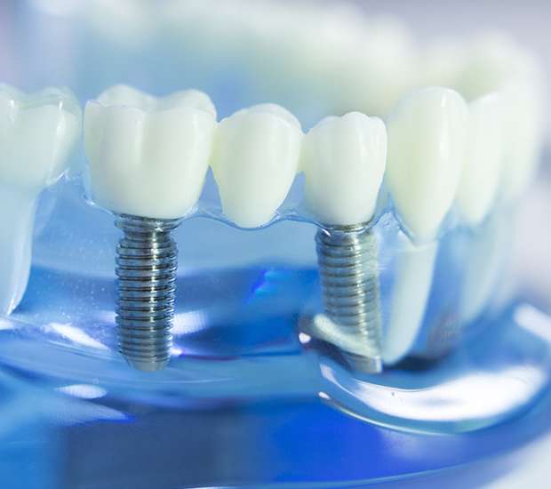 Port Chester Dental Prosthetics