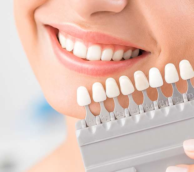 Port Chester Veneers