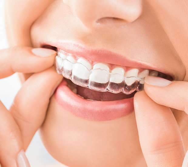 Port Chester Does Invisalign® Really Work?