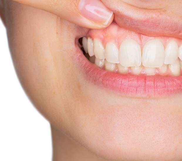 Port Chester Gum Disease