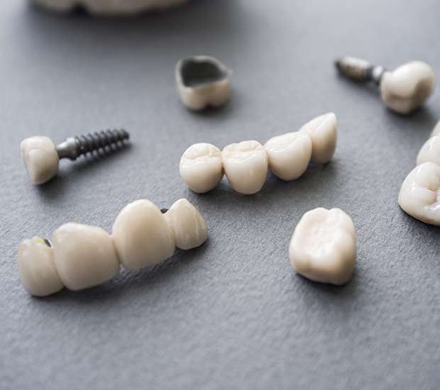Port Chester The Difference Between Dental Implants and Mini Dental Implants
